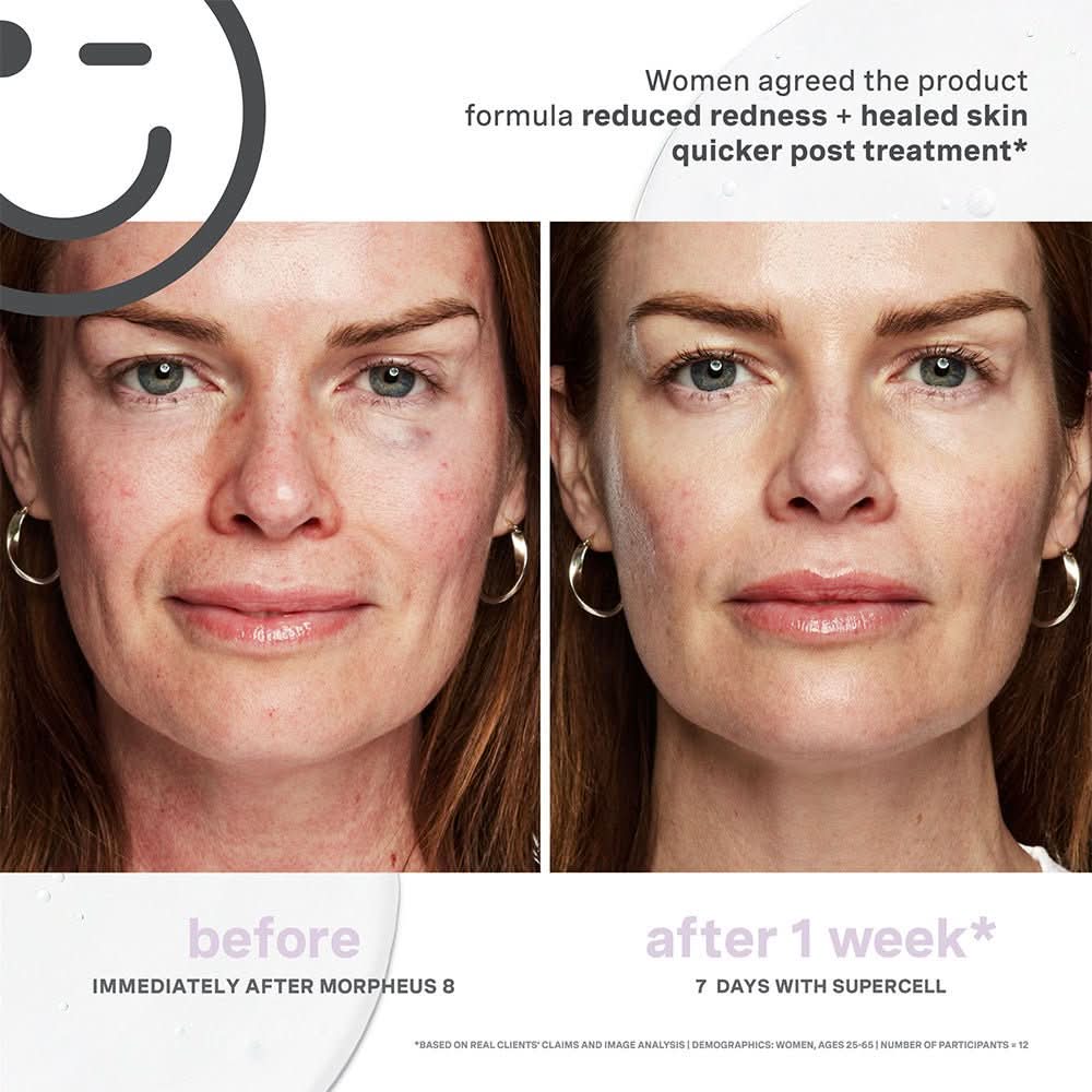 Kate Somerville Kateceuticals Supercell Rejuvenation Serum - 1oz/30