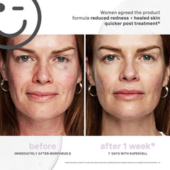Kate Somerville Kateceuticals Supercell Rejuvenation Serum - 1oz/30