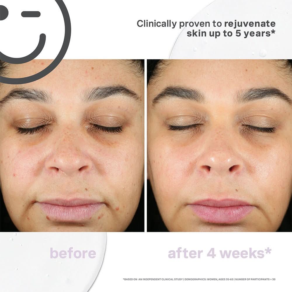 Kate Somerville Kateceuticals Supercell Rejuvenation Serum - 1oz/30