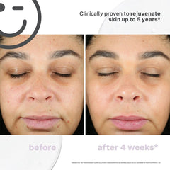 Kate Somerville Kateceuticals Supercell Rejuvenation Serum - 1oz/30