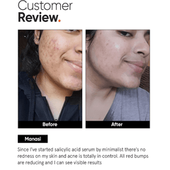 Minimalist 2% Salicylic Acid Serum For Oily Skin 30ml