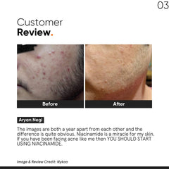 Minimalist Niacinamide 10% Skin Clarifying Anti-Acne Face Serum 30ml