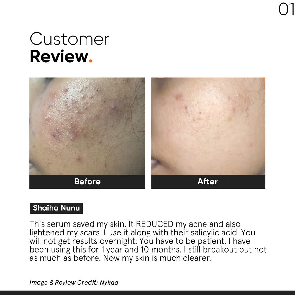 Minimalist Niacinamide 10% Skin Clarifying Anti-Acne Face Serum 30ml