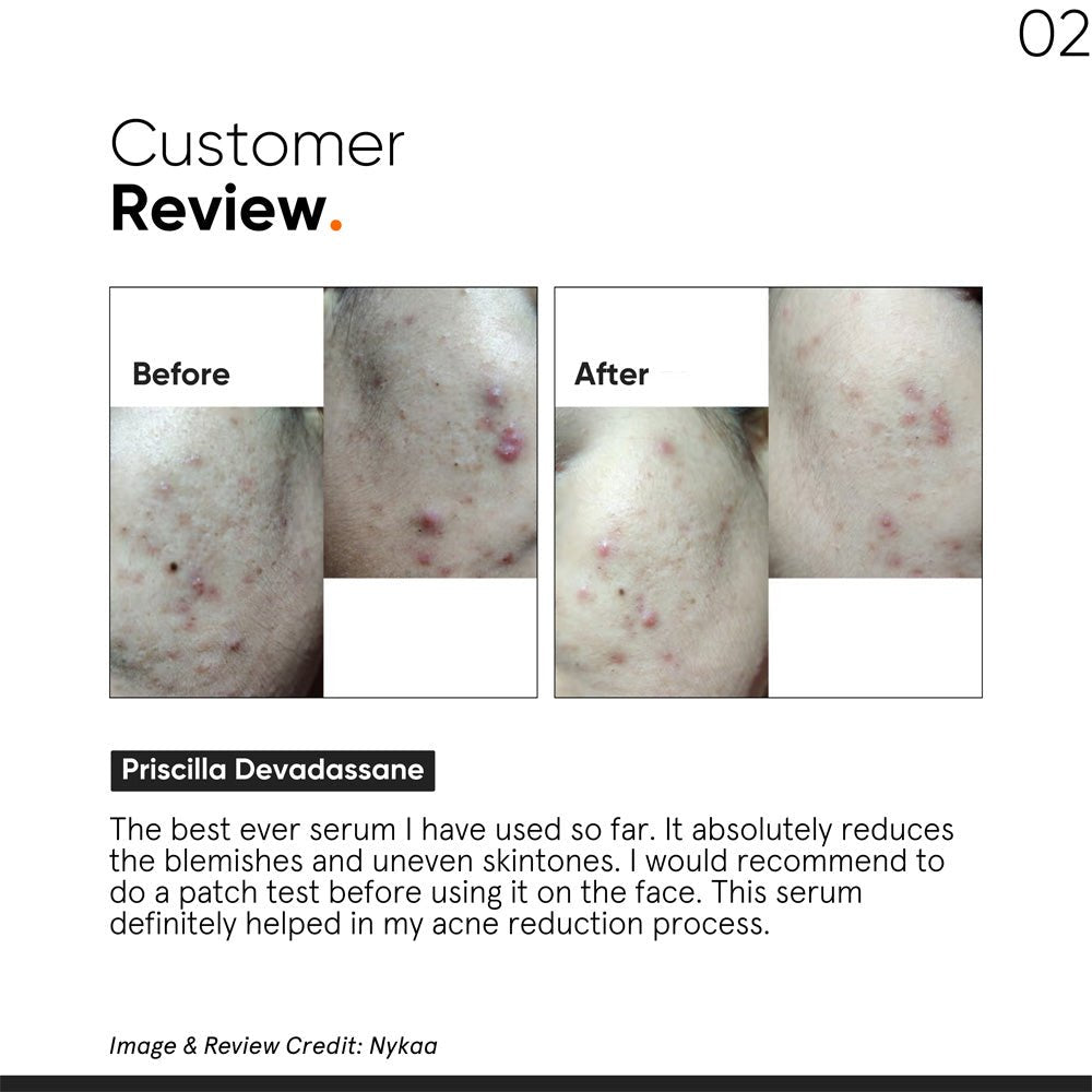 Minimalist Niacinamide 10% Skin Clarifying Anti-Acne Face Serum 30ml