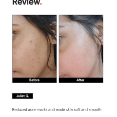 Minimalist Niacinamide 5% Face Serum with Vit B3 30ml