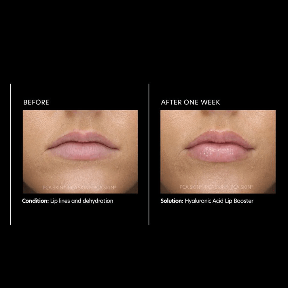 PCA Hyaluronic Acid Lip Booster 6g