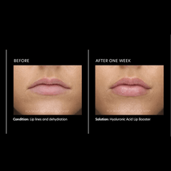 PCA Hyaluronic Acid Lip Booster 6g