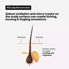 Serie Expert Scalp Advanced Anti-Discomfort Intense Soother Treatment