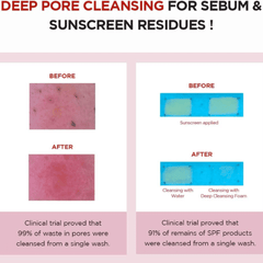 غسول رغوي منظف عميق للمسام من سكين 1004 مدغشقر سنتيلا، 125 مل