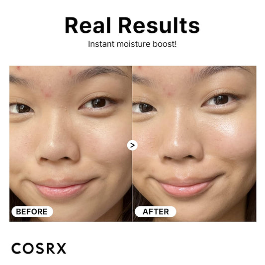 COSRX - The Hyaluronic Acid 3 Serum