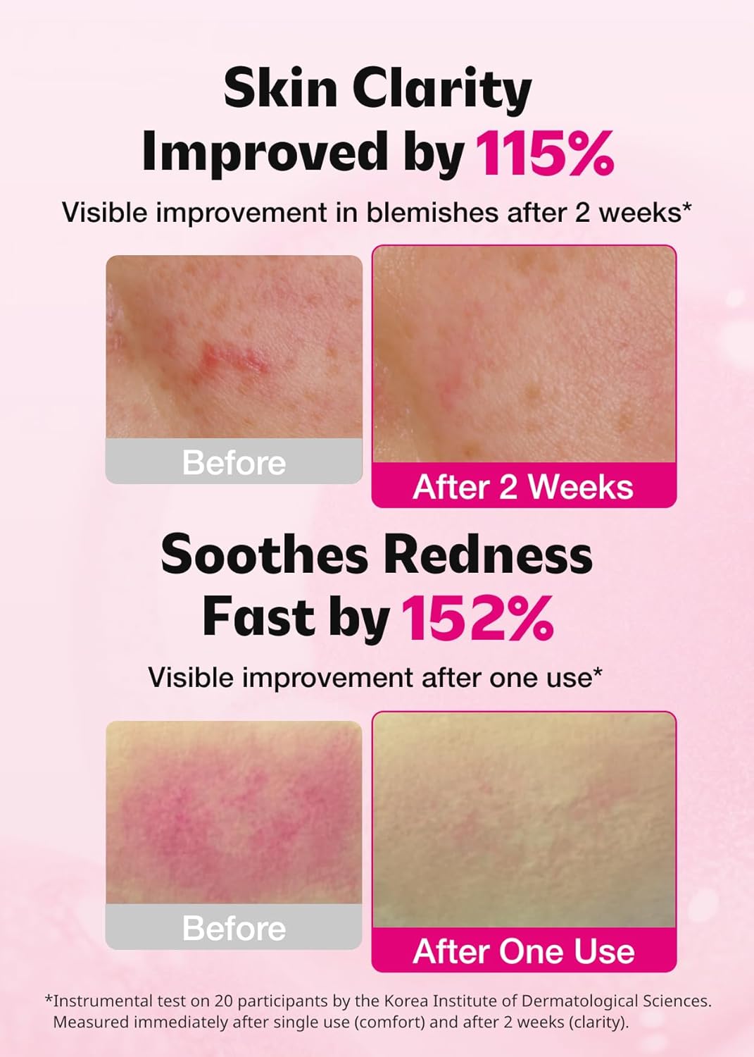 ISOI - Brightening Serum