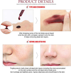 so natural - Red Peel Tingle Serum