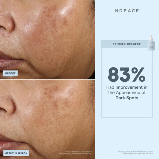NuFACE Super Vita-C Booster Serum 30ml