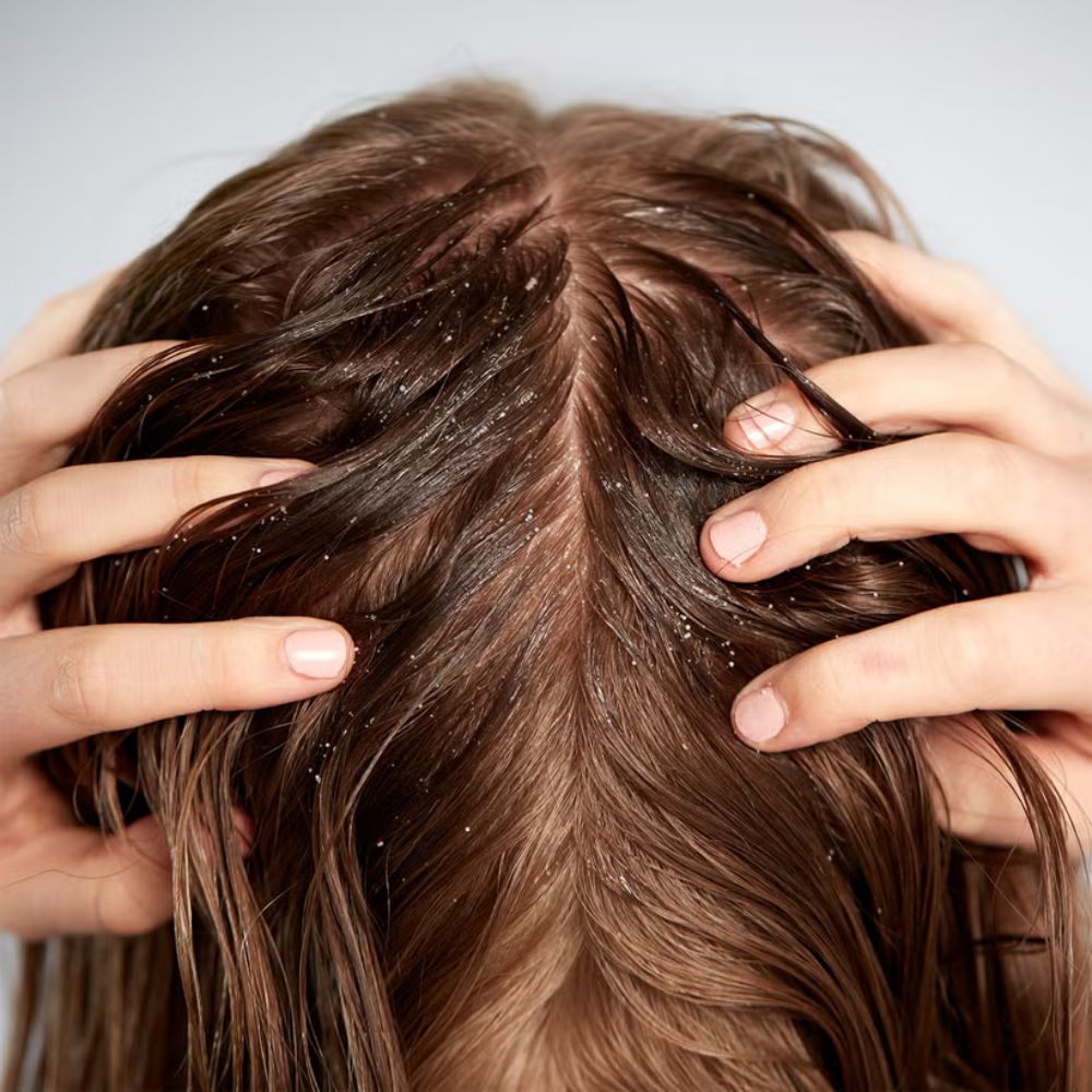 مقشر فروة الرأس المنقي من أميلوريت 125 مل