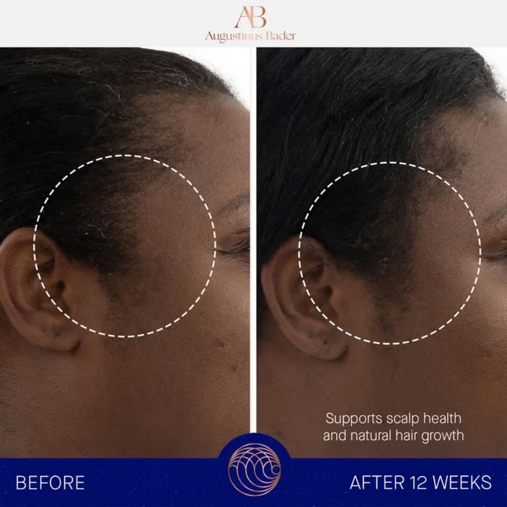 Augustinus Bader The Scalp Treatment 30ml
