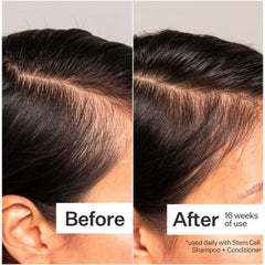 Act+Acre 3% Stem Cell Peptide H3-Grow+ Complex Scalp Treatment For Hair Thinning and Growth 89ml