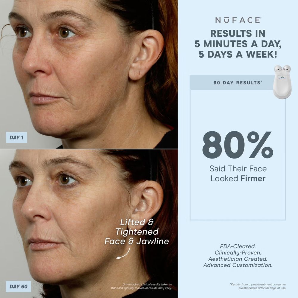 NuFACE Trinity Wrinkle Reducer (TWR) Attachment