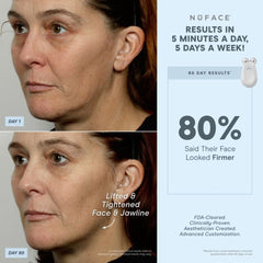 NuFACE Trinity Wrinkle Reducer (TWR) Attachment