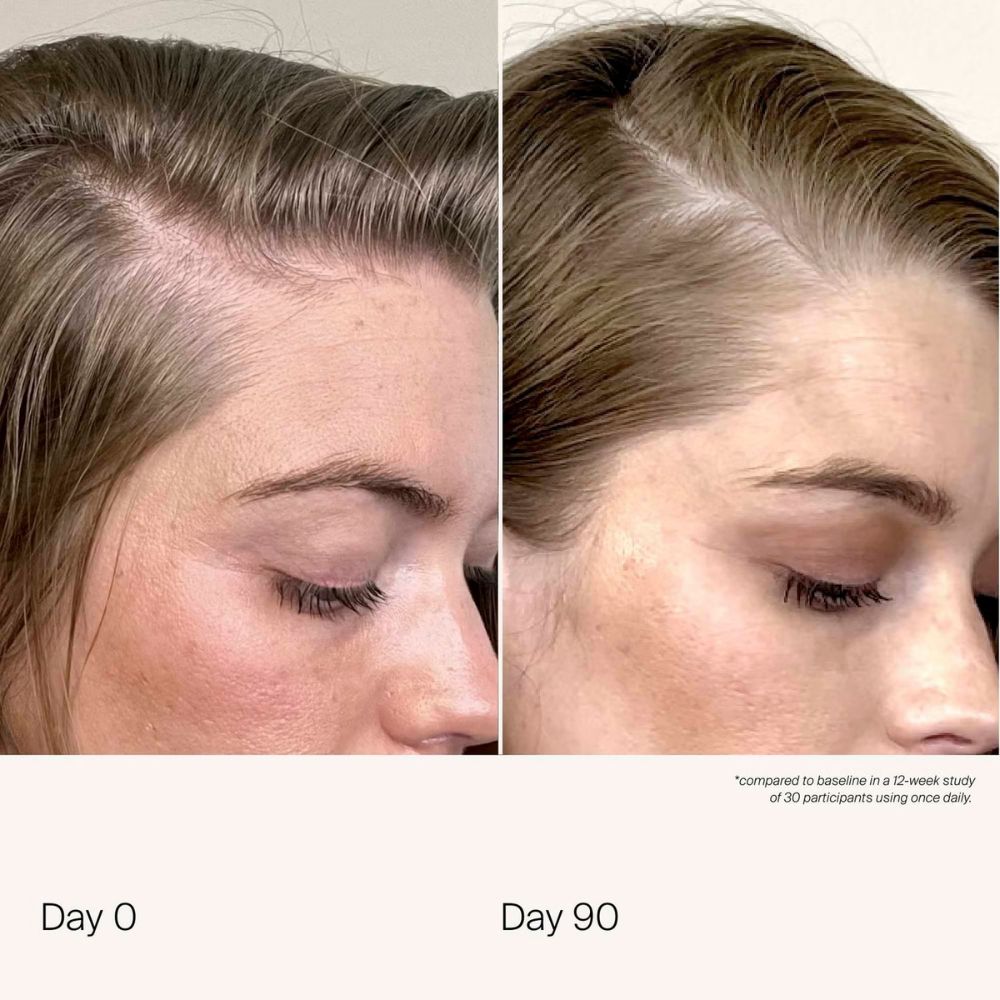 Living Proof Scalp Care Density Serum 50ml