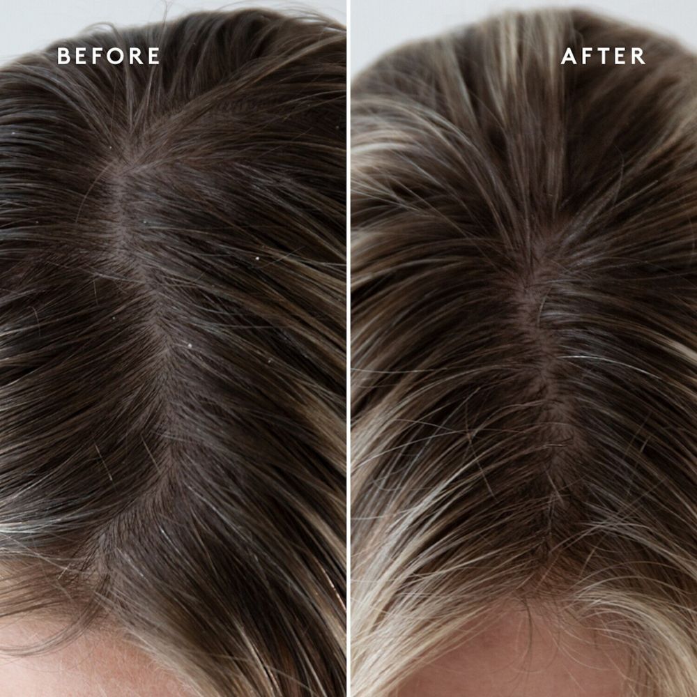 VIRTUE SCALP TOPICAL HAIR SUPPLEMENT