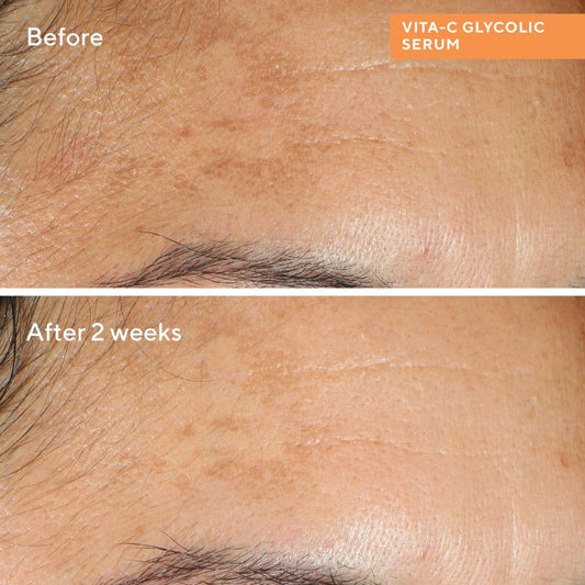 مراد فيتا-سي جليكوليك لتفتيح البشرة 30 مل