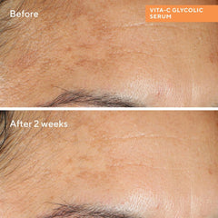 مراد فيتا-سي جليكوليك لتفتيح البشرة 30 مل