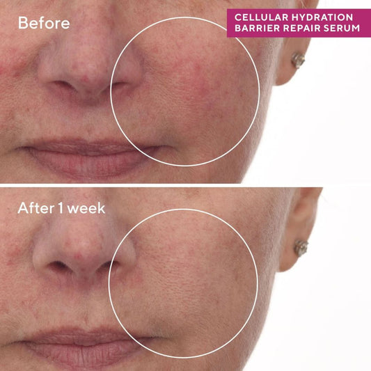 مصل مراد لإصلاح حاجز ترطيب الخلايا 28 غرام