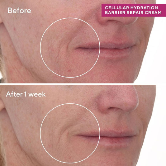 كريم مراد لإصلاح حاجز ترطيب الخلايا 48 غرام