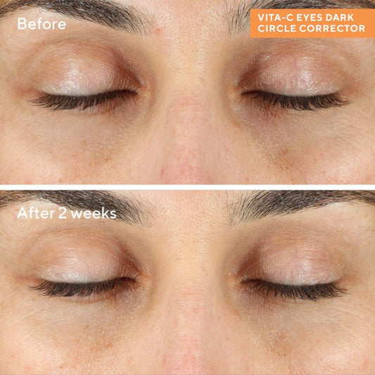 مراد فيتا-سي مصحح الهالات السوداء للعينين 15 مل
