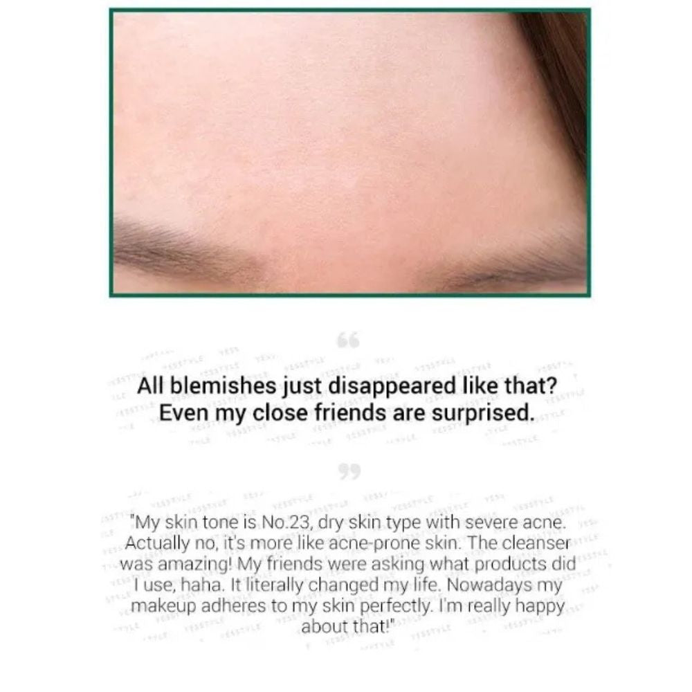 صابونة تنظيف معجزة من SOME BY MI - AHA، BHA، PHA، تدوم 30 يومًا، قطعة واحدة