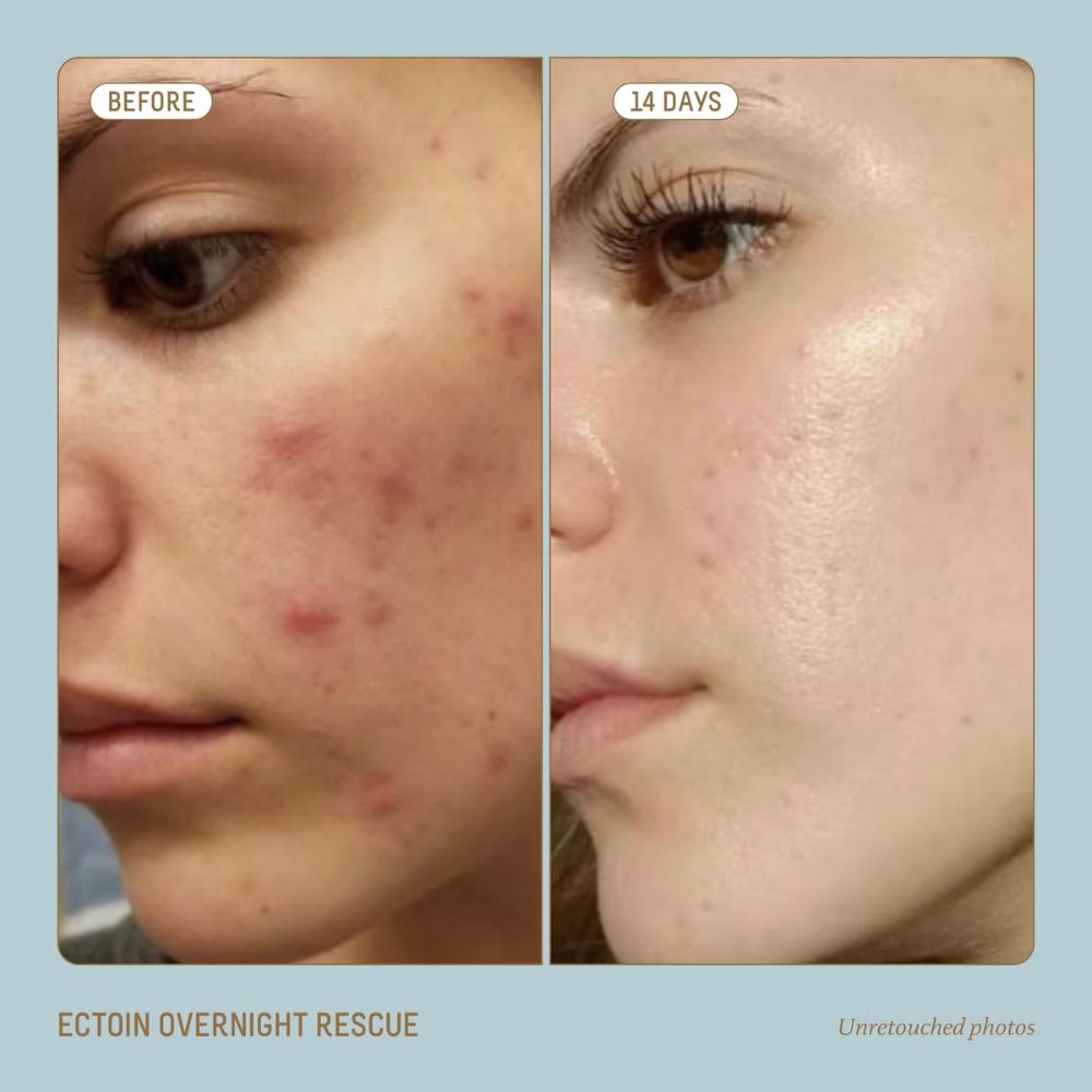 Biossance Squalane and Ectoin Overnight Rescue 50ml