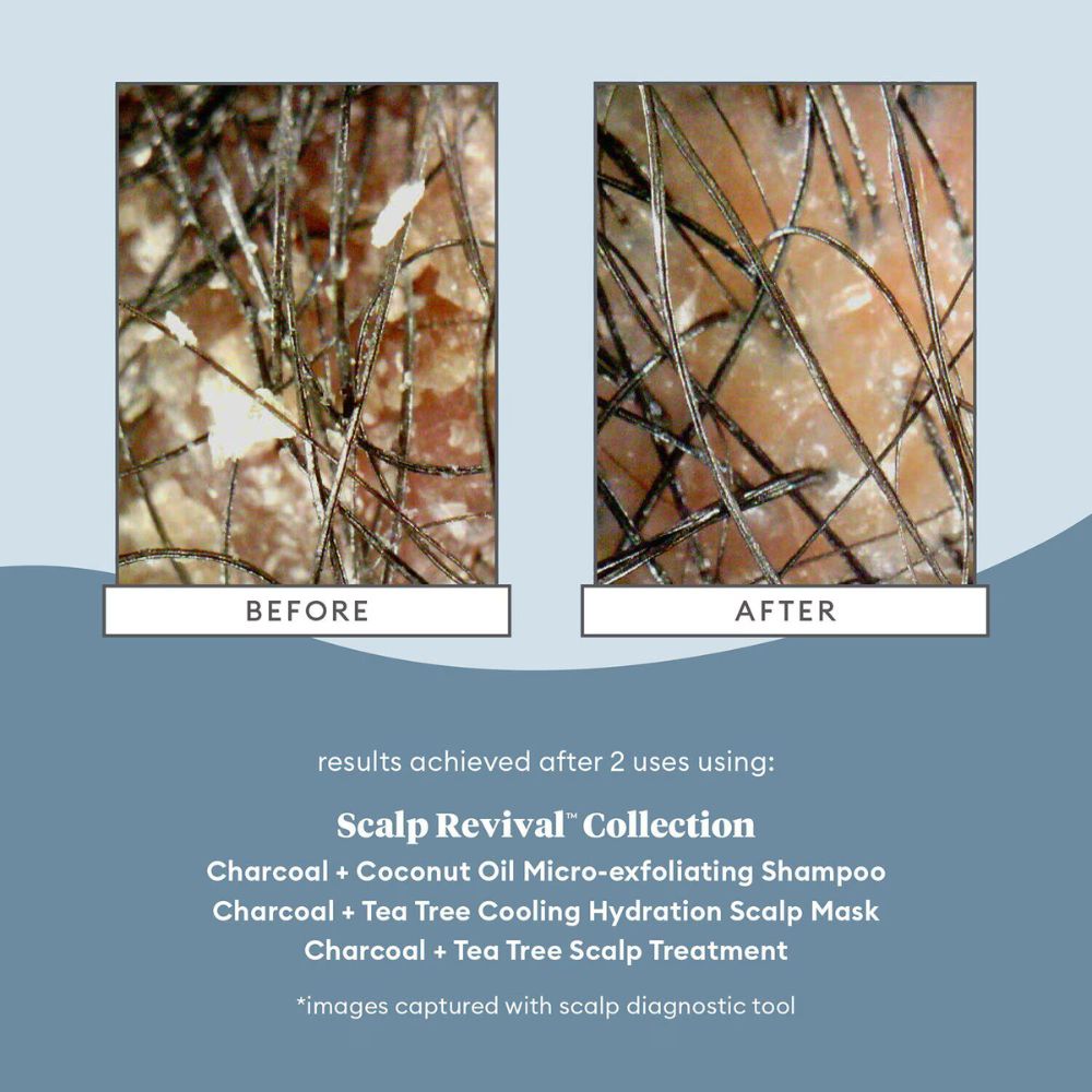 BRIOGEO Scalp Revival™ Charcoal + Coconut Oil Micro-exfoliating Shampoo