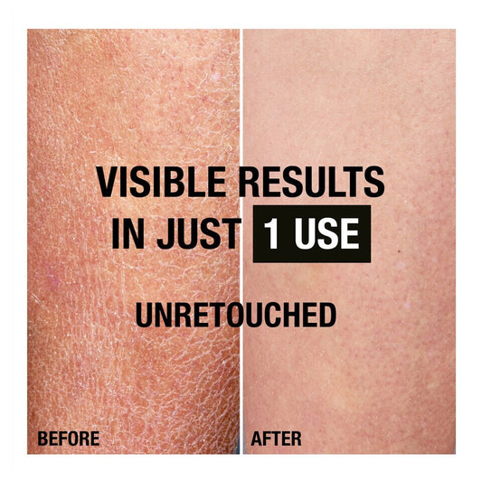 Neutrogena Norwegian Formula Deep Moisture Body Lotion for Dry Skin 400ml