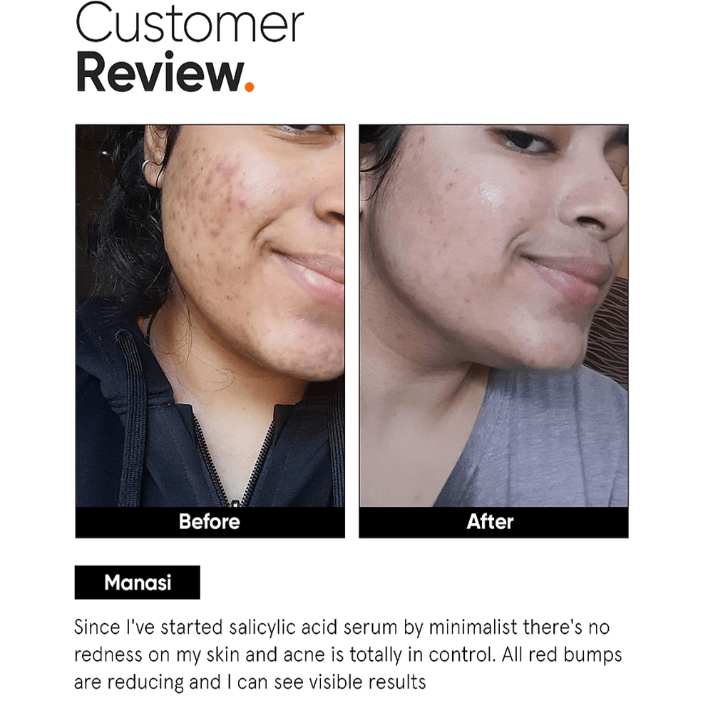 Minimalist 2% Salicylic Acid Serum For Oily Skin 30ml